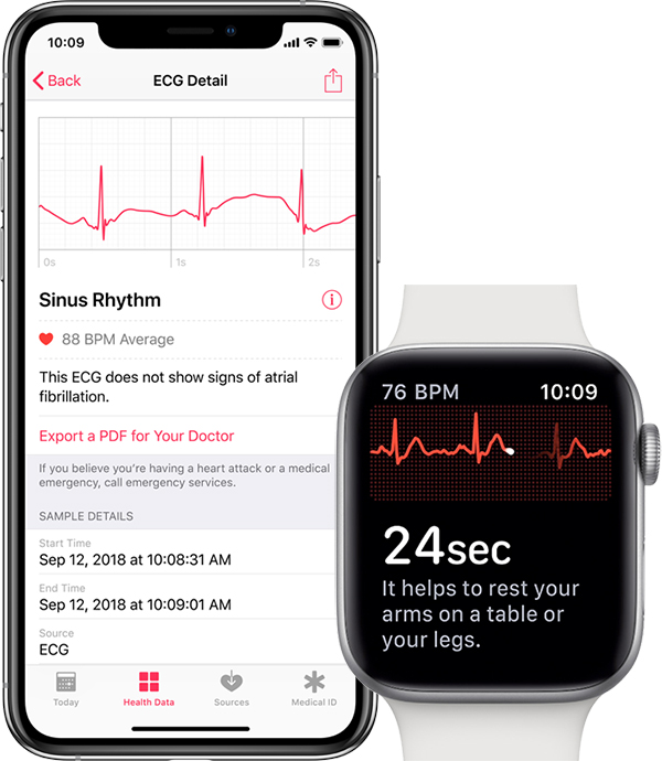 apple ecg export pdf doctor How to do an ECG with Apple Watch
