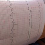 Efecto Doppler: 5 Claves para Entender este Fenómeno Físico 3 efecto doppler