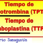 Tpt que es: 7 claves fundamentales para entenderlo hoy 5 tpt que es