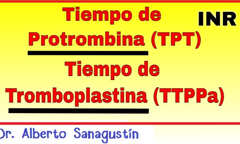 Tpt que es: 7 claves fundamentales para entenderlo hoy 1 tpt que es